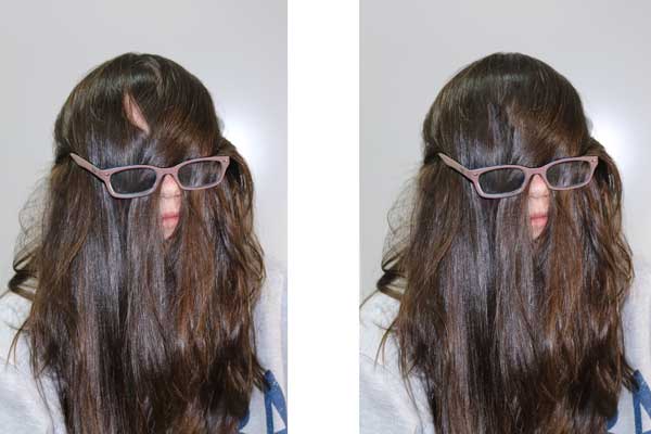 KT as Cousin Itt: Before and After